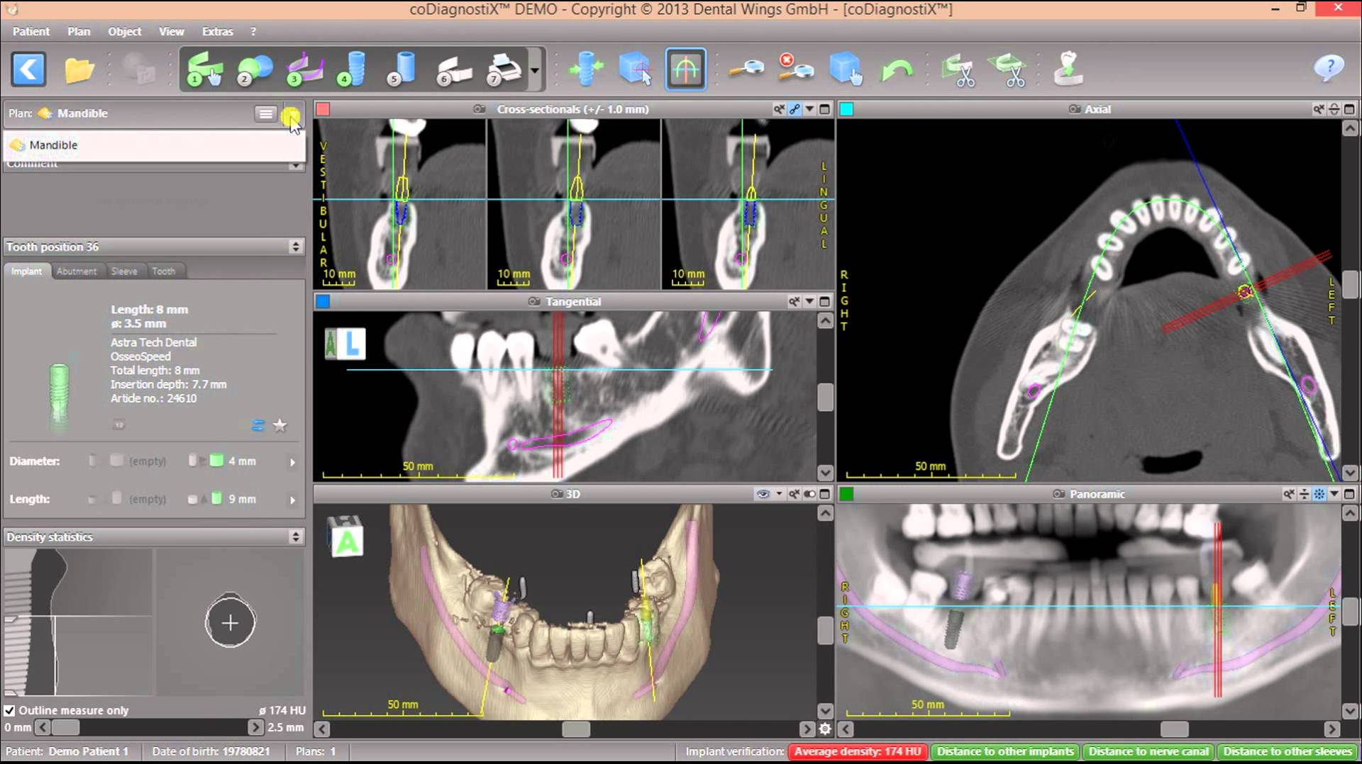 coDiagnostiX picture or screenshot